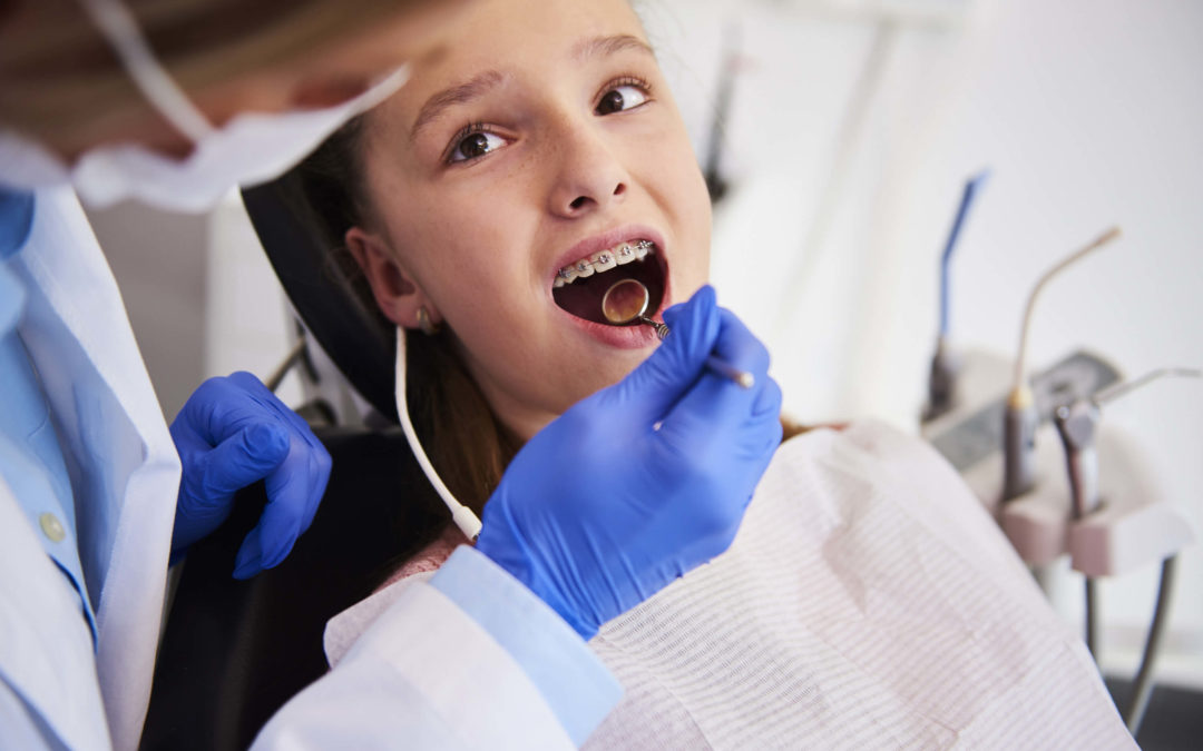 5 Signs That You Should Take Your Child to an Orthodontist