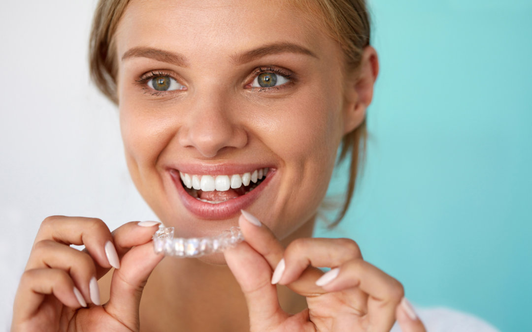 5 Reasons You and Your Child Will Love Invisalign