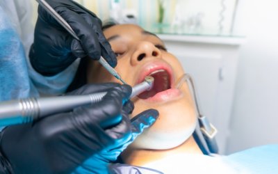 7 Questions to Ask Before Choosing an Orthodontist in Glenview, IL