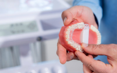 Invisalign Vernon Hills: 7 Tips for Getting Started