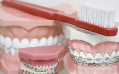7 Mistakes to Avoid When Choosing an Orthodontist in Glenview, IL