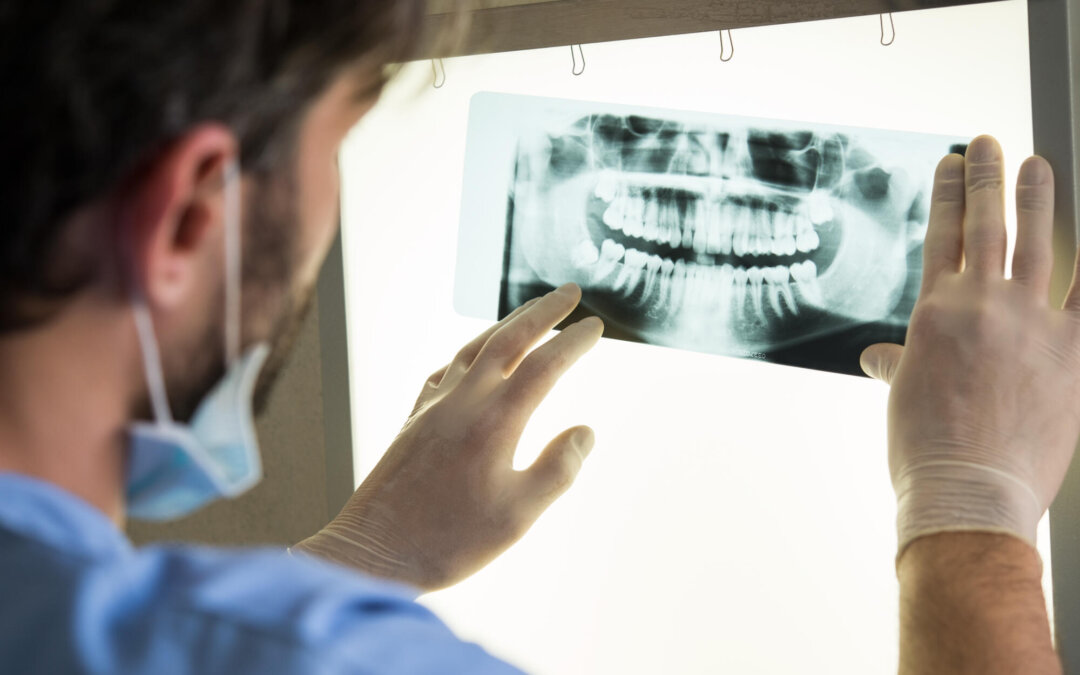 Ways to Overcome Overcrowding With Your Vernon Hills Orthodontist