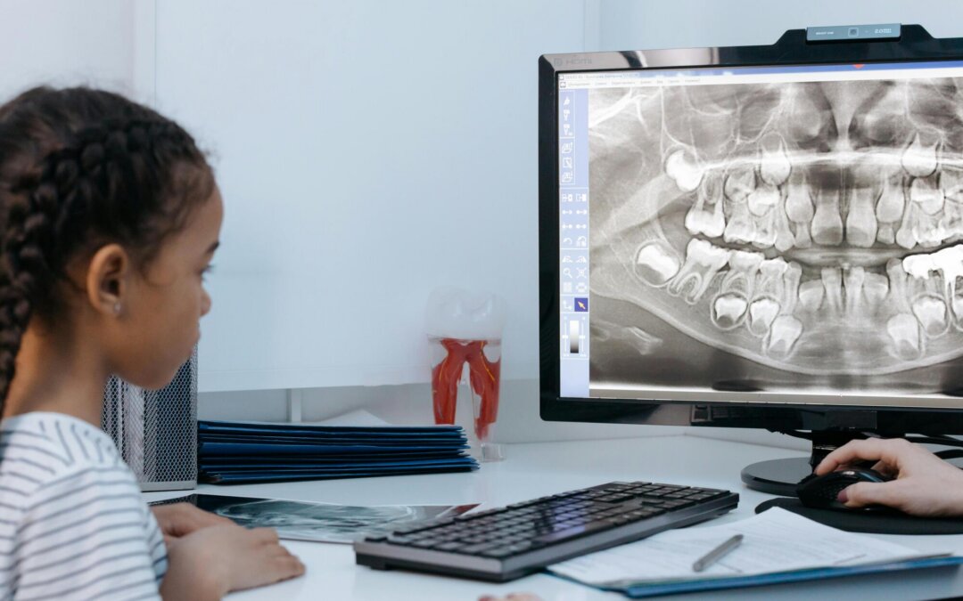 How Young for Invisalign? What Glenview, IL Orthodontists Recommend
